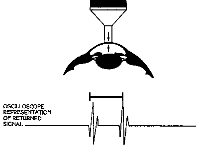 Ultraschall-Pachymetrie